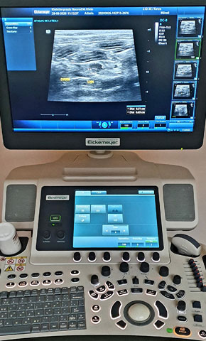 Ultraschallgerät für Untersuchungen Ihres Haustieres