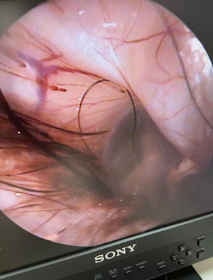 Videoendoskopie-Einsatz Kleintierpraxis Klein Auringen